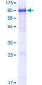 NMD3 Protein - 12.5% SDS-PAGE of human NMD3 stained with Coomassie Blue