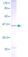NME1 / NM23 Protein - 12.5% SDS-PAGE of human NME1 stained with Coomassie Blue
