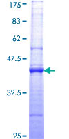 NME1 / NM23 Protein - 12.5% SDS-PAGE Stained with Coomassie Blue.