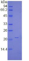 NME1 / NM23 Protein - Recombinant Non Metastatic Cells 1, Protein NM23A Expressed In By SDS-PAGE