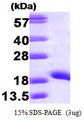 NME1 / NM23 Protein