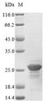 NME2 Protein - (Tris-Glycine gel) Discontinuous SDS-PAGE (reduced) with 5% enrichment gel and 15% separation gel.