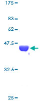 NME2 Protein - 12.5% SDS-PAGE of human NME2 stained with Coomassie Blue