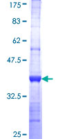 NME2 Protein - 12.5% SDS-PAGE Stained with Coomassie Blue.