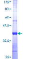 NME2 Protein - 12.5% SDS-PAGE Stained with Coomassie Blue.