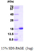 NME2 Protein