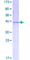 NME3 Protein - 12.5% SDS-PAGE of human NME3 stained with Coomassie Blue