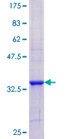NME3 Protein - 12.5% SDS-PAGE Stained with Coomassie Blue.