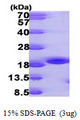 NME3 Protein