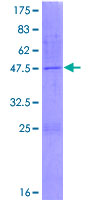 NME4 Protein - 12.5% SDS-PAGE of human NME4 stained with Coomassie Blue
