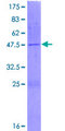 NME4 Protein - 12.5% SDS-PAGE of human NME4 stained with Coomassie Blue