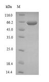 NME4 Protein - (Tris-Glycine gel) Discontinuous SDS-PAGE (reduced) with 5% enrichment gel and 15% separation gel.