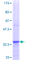 NME4 Protein - 12.5% SDS-PAGE Stained with Coomassie Blue.