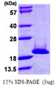 NME4 Protein