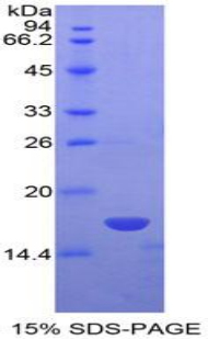 NME4 Protein - Recombinant Non Metastatic Cells 4, Protein NM23A Expressed In By SDS-PAGE