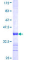 NME5 Protein - 12.5% SDS-PAGE Stained with Coomassie Blue.