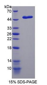 NME5 Protein - Recombinant Non Metastatic Cells 5, Protein NM23A Expressed In By SDS-PAGE