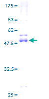 NME6 Protein - 12.5% SDS-PAGE of human NME6 stained with Coomassie Blue