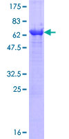 NME7 Protein - 12.5% SDS-PAGE of human NME7 stained with Coomassie Blue