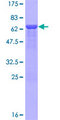 NMI Protein - 12.5% SDS-PAGE of human NMI stained with Coomassie Blue