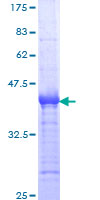NMI Protein - 12.5% SDS-PAGE Stained with Coomassie Blue.
