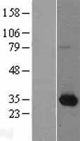 NMNAT1 / NMNAT Protein - Western validation with an anti-DDK antibody * L: Control HEK293 lysate R: Over-expression lysate
