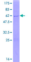 NMNAT1 / NMNAT Protein - 12.5% SDS-PAGE of human NMNAT1 stained with Coomassie Blue