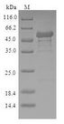 NMNAT1 / NMNAT Protein - (Tris-Glycine gel) Discontinuous SDS-PAGE (reduced) with 5% enrichment gel and 15% separation gel.