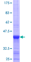 NMNAT1 / NMNAT Protein - 12.5% SDS-PAGE Stained with Coomassie Blue.