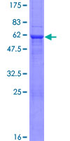 NMNAT2 Protein - 12.5% SDS-PAGE of human NMNAT2 stained with Coomassie Blue