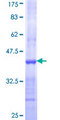 NMNAT2 Protein - 12.5% SDS-PAGE Stained with Coomassie Blue.