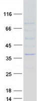 NMNAT2 Protein - Purified recombinant protein NMNAT2 was analyzed by SDS-PAGE gel and Coomassie Blue Staining