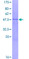 NMNAT3 Protein - 12.5% SDS-PAGE of human NMNAT3 stained with Coomassie Blue