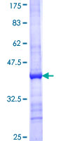 NMNAT3 Protein - 12.5% SDS-PAGE Stained with Coomassie Blue.