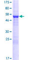 NMRAL1 / HSCARG Protein - 12.5% SDS-PAGE of human NMRAL1 stained with Coomassie Blue