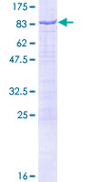 NMT1 Protein - 12.5% SDS-PAGE of human NMT1 stained with Coomassie Blue