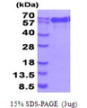 NMT1 Protein