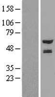 NMT2 Protein - Western validation with an anti-DDK antibody * L: Control HEK293 lysate R: Over-expression lysate