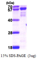 NMT2 Protein