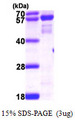 NMT2 Protein