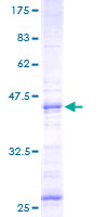 NMU / Neuromedin U Protein - 12.5% SDS-PAGE of human NMU stained with Coomassie Blue