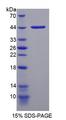 NMU / Neuromedin U Protein - Recombinant  Neuromedin U By SDS-PAGE