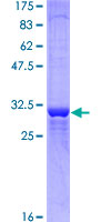 NMUR1 Protein - 12.5% SDS-PAGE Stained with Coomassie Blue.