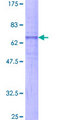 NMUR2 Protein - 12.5% SDS-PAGE of human NMUR2 stained with Coomassie Blue