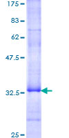 NMUR2 Protein - 12.5% SDS-PAGE Stained with Coomassie Blue.