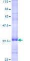 NMUR2 Protein - 12.5% SDS-PAGE Stained with Coomassie Blue.