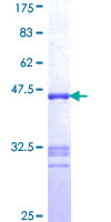 NNA1 / AGTPBP1 Protein - 12.5% SDS-PAGE Stained with Coomassie Blue.