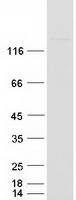 NNA1 / AGTPBP1 Protein - Purified recombinant protein AGTPBP1 was analyzed by SDS-PAGE gel and Coomassie Blue Staining