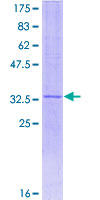 NNAT / Neuronatin Protein - 12.5% SDS-PAGE of human NNAT stained with Coomassie Blue