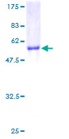 NNMT Protein - 12.5% SDS-PAGE of human NNMT stained with Coomassie Blue